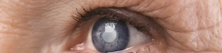 Grauer Star Bremen | Diagnose und Behandlung in der Augenpraxis Heuck