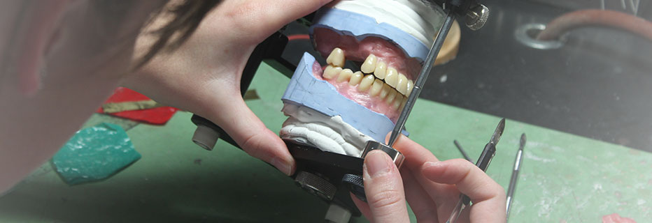 Digitale Prothesen in Bad Segeberg