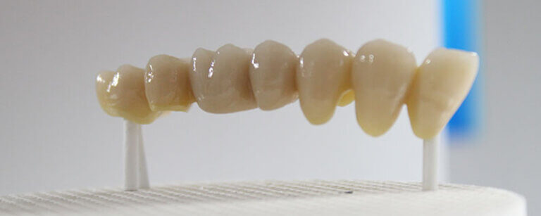 Digitale Prothesen in Bad Segeberg